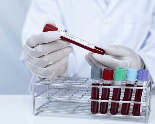 男精子发黄怎么回事 精子头部畸形率正常值是多少,正规助孕公司