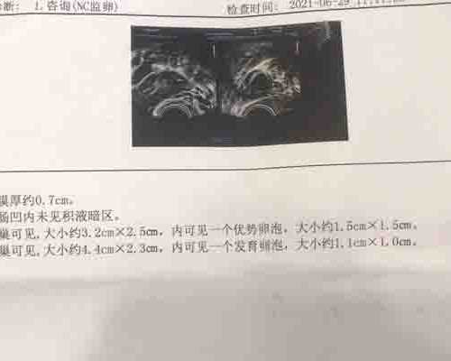 自然流产后的注意事项,为什么不能清宫?,权威怀孕机构